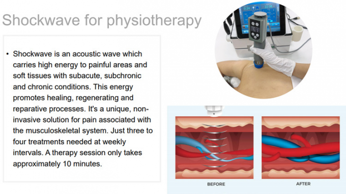 Équipement de thérapie de physiothérapie/onde choc extracorporeal/soulagement de la douleur tecar de thérapie thérapie d'onde de choc